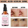 Multifunctional Facial Serum with Kojic Acid, Arbutin and Glutathione Dark Skin Whitening and Dark Spot Brightening 30ml