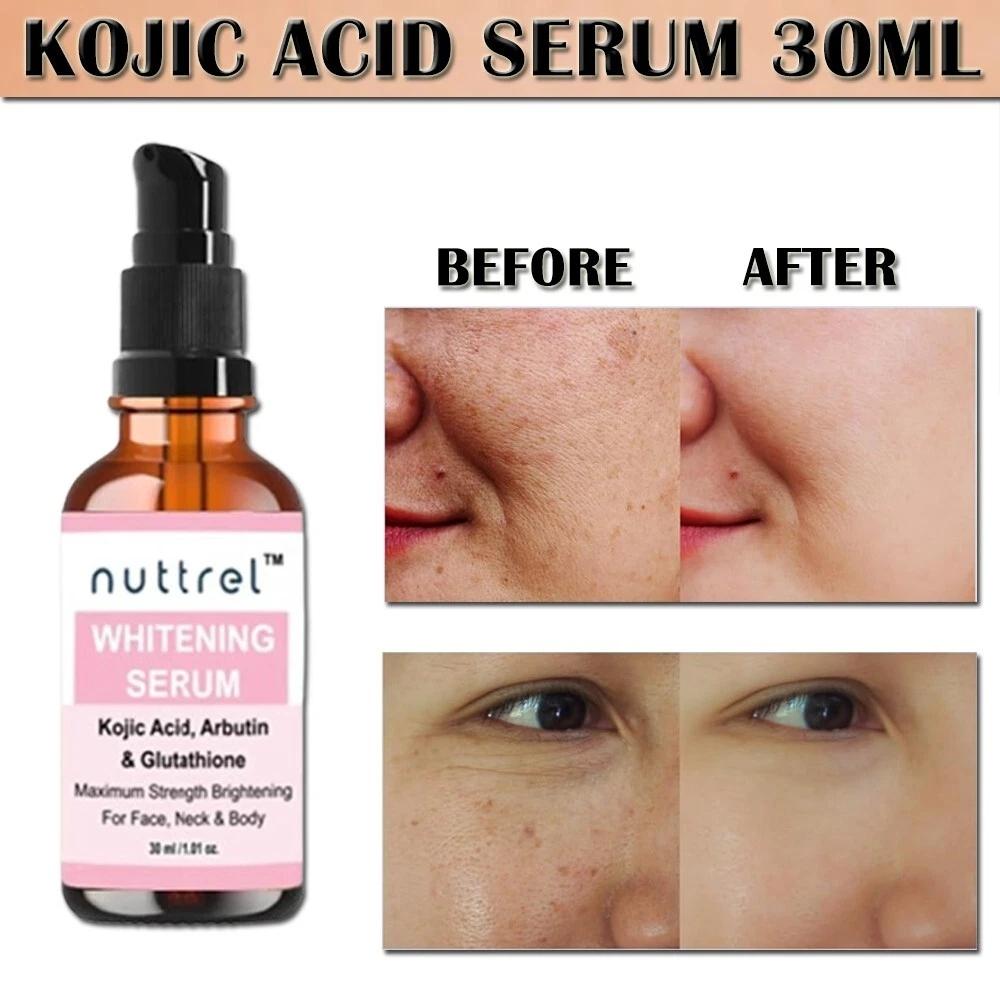 Multifunctional Facial Serum with Kojic Acid, Arbutin and Glutathione Dark Skin Whitening and Dark Spot Brightening 30ml