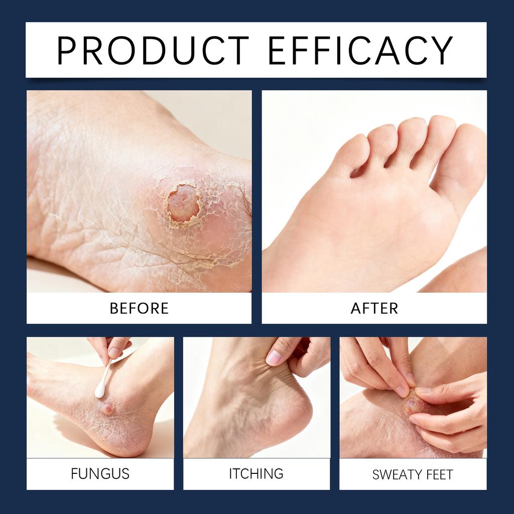 Foot Care Patches Are Convenient To Fit, Skin-friendly And Comfortable. They Gently Care For The Delicate Skin Your Feet In Daily Life.