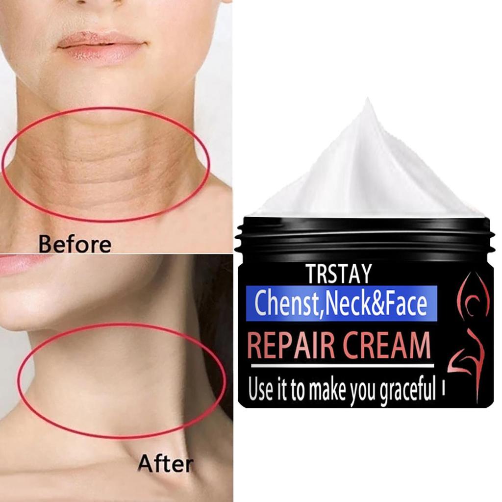 The Moisturizing Cream Is Gentle and Non-irritating, Hydrating and Nourishing the Skin, Leaving It Soft and Refined