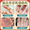 Thai Hand & Foot Ointment - Repair Dry, Peeling Skin