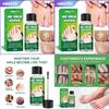 Hbesty Herbal Nail Fungus Treatment Liquid For Effective Foot Care And Healing