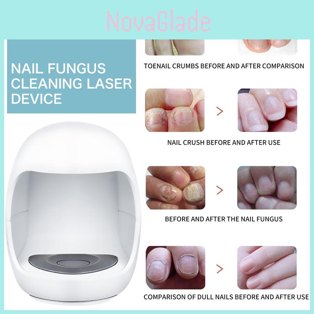 South Moon Nail Care Device For Thick Brittle And Cracked Nails Long-lasting Treatment