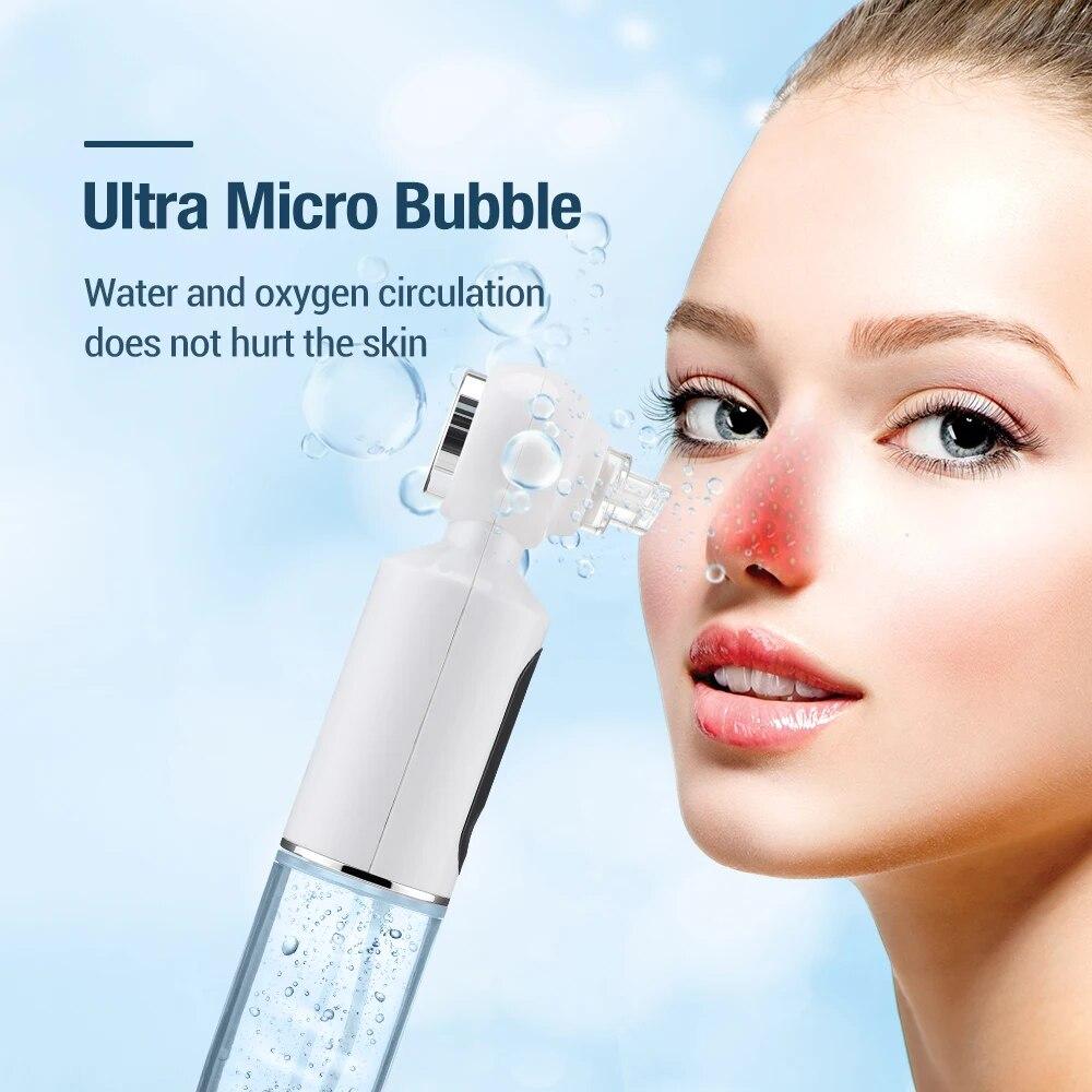 Water Cycle Blackhead Remover Hot Compress Pore Cleaner Vacuum Suction For Acne Pimple Black Dot Removal Skin Care Tools