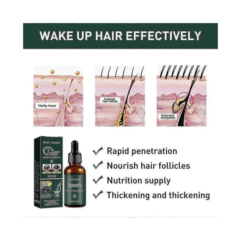 7days Hair Growing Serum, Anti-detachment,hair Development30ml