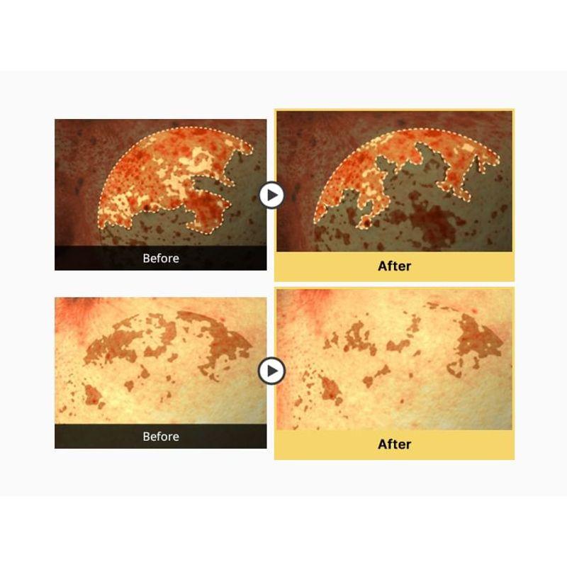 Meditherapy Melajuran White Toning Cream