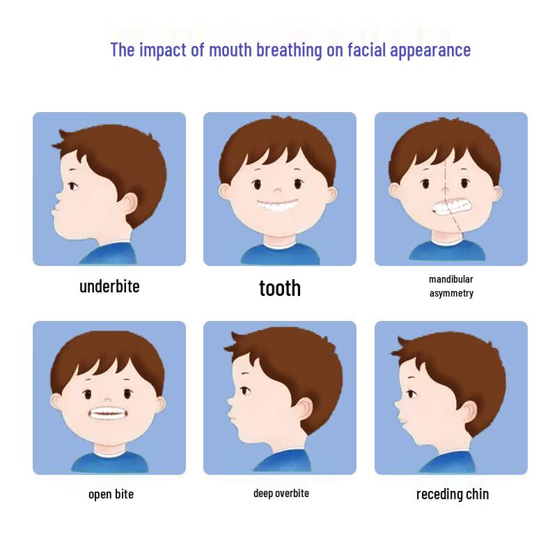 Little Deer Mom Mouth Breathing Correction Patches