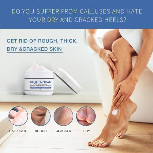 Rosarden Foot Cream & Lotion - Dry Foot Cream - Dry Foot Cream - Dry Foot Lotion - Foot Heal Cream - Foot Lotion for Dry Feet