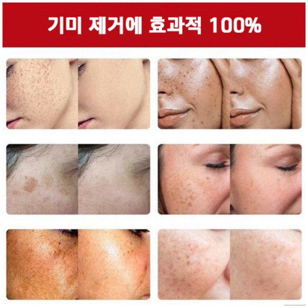 Ampoule éclaircissante Spot Ampoule d'essence blanchissante Élimine les taches de rousseur et les taches de vieillesse, améliore la pigmentation du visage, 30 ml, 1 pièce