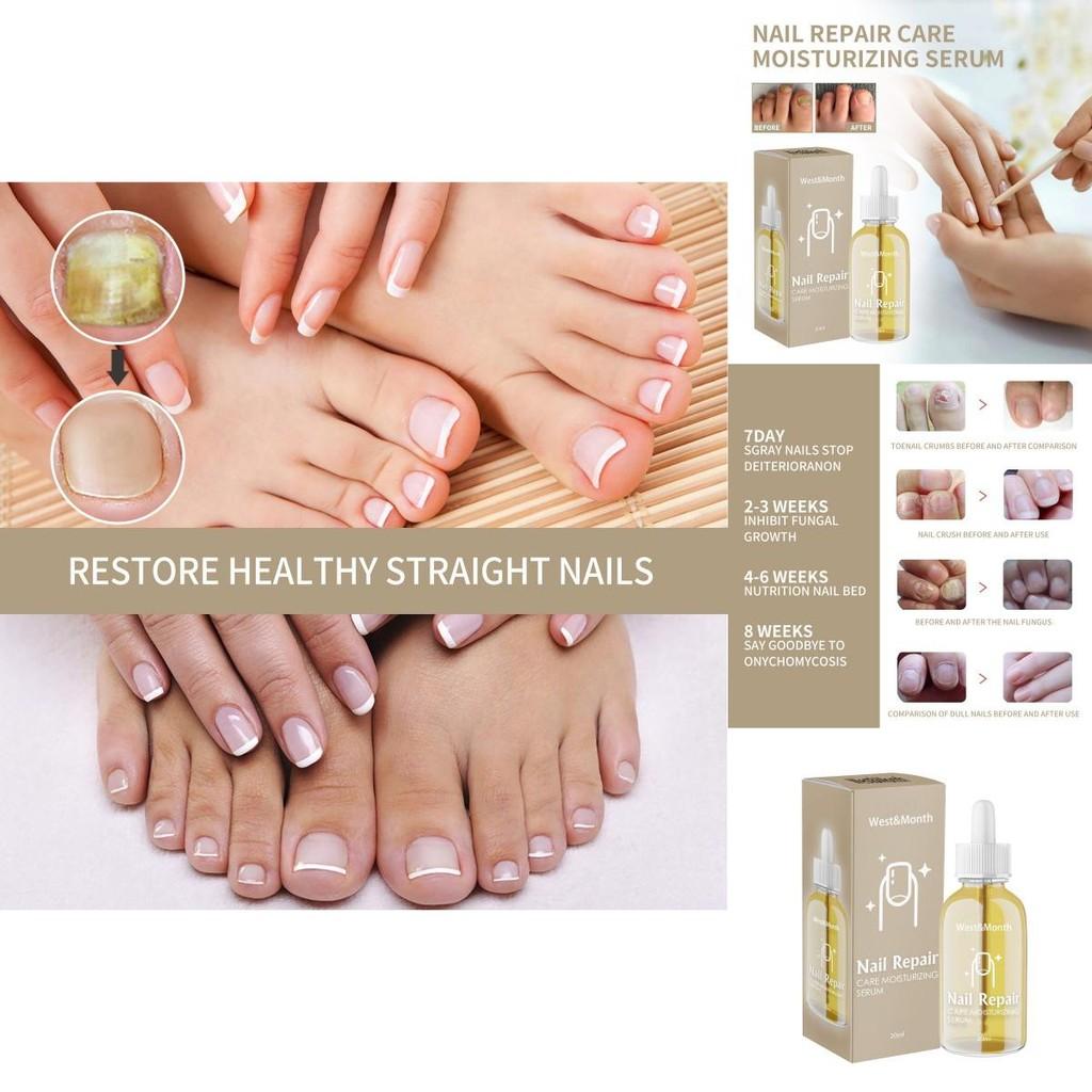 Essence de Réparation pour Ongles West Month Traitement Nourrissant pour Ongles et Orteils Endommagés 20ml