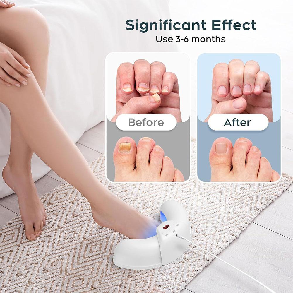 Nail Repair Solution Home Use Nail Cleaning Light Device 470nm Blue Light Nail Treatment Device for Toenails & Fingernails