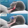 Universal Anti-Snoring Mouthpiece Quiet Sleep Aid Device Compatible with Honex 2025 Latest Model