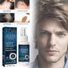 East Moon Men's Hair Growth Spray For Thicker Hairline And Prevents Hair Loss