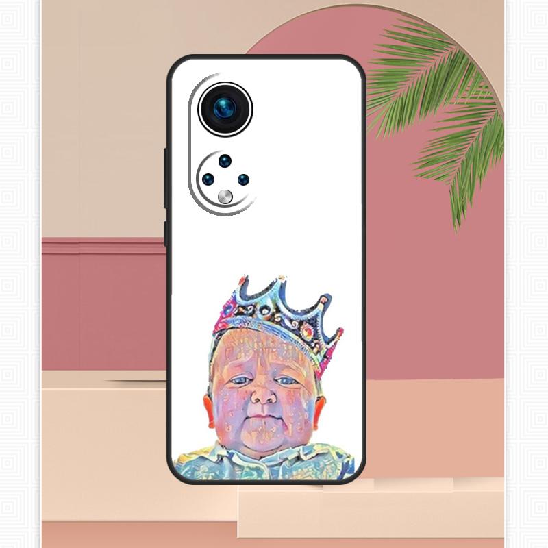 

Funny hasbulla Case For Honor Magic 7 Lite 5 6 8 Pro Honor 200 400 X9c X9b X9a X8b X8a X8c 50 70 90 Cover Honor X8c