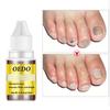 OEDO Nail Treatment Essence Oil Moisturizing Fungus Removal Foot Care Liquid