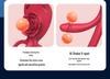Mano Wearable Couple's Vibrator with App Control for Flirting and Fun
