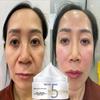 Whitening Brightening Essence Cream Smooths Wrinkles, Evenly Nourishes, Repairs, Moisturizes and Moisturizes Skin Cream
