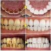 SP-6 Probiotic Whitening Toothpaste with SP4 Fresh Breath Enzyme, Brightening & Stain Removing for Teeth Whitening and Fresh Breath