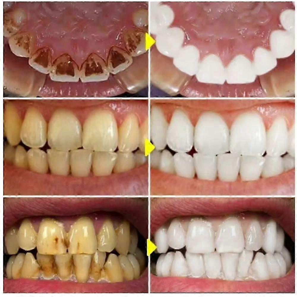 SP-6 Probiotic Whitening Toothpaste with SP4 Fresh Breath Enzyme, Brightening & Stain Removing for Teeth Whitening and Fresh Breath