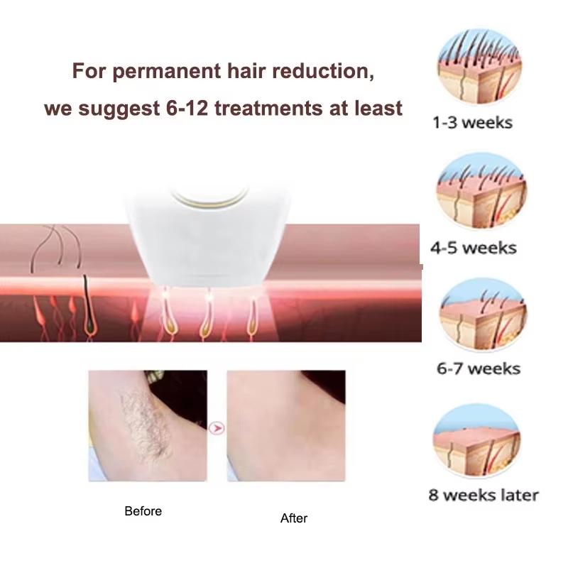 IPL Haarentfernung Laser Epilierer Schneller Blitz Haarentferner Schmerzlos Permanent Photoepilator Ganzkörperbehandlung Für Frauen