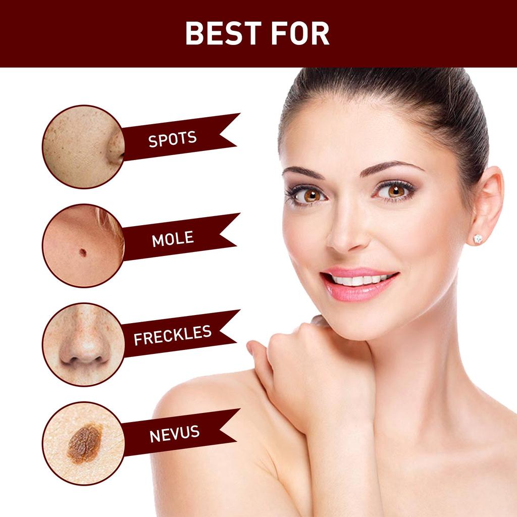 Tags & Moles Remover, WipeOff Tags & Moles Remover, WipeOff Remover 3ML