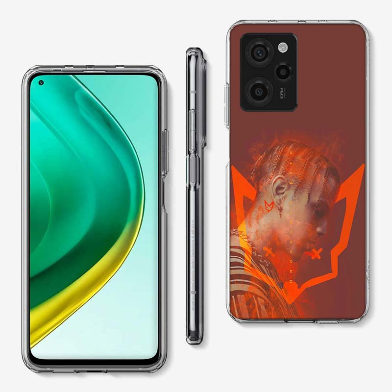 R-Rauw Alejandro Rapper Cover Telefonfodral För Xiaomi Poco M8 M7 M6 M4 M3 X7 X6 X4 Pro F7 Ultra M5S Mi 14 14T 15 15T 12T 10T Pro 1