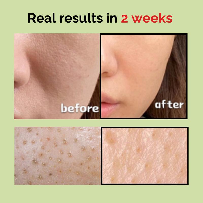 MOMMY CARE Sea Grape Ampoule