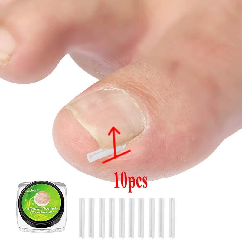 10 sztuk/zestaw wrastający paznokieć Pad elastyczny Ortho wypełnianie paznokci podkładka do rowków wrastający korektor do paznokci drut artefakt narzędzie do pielęgnacji stóp