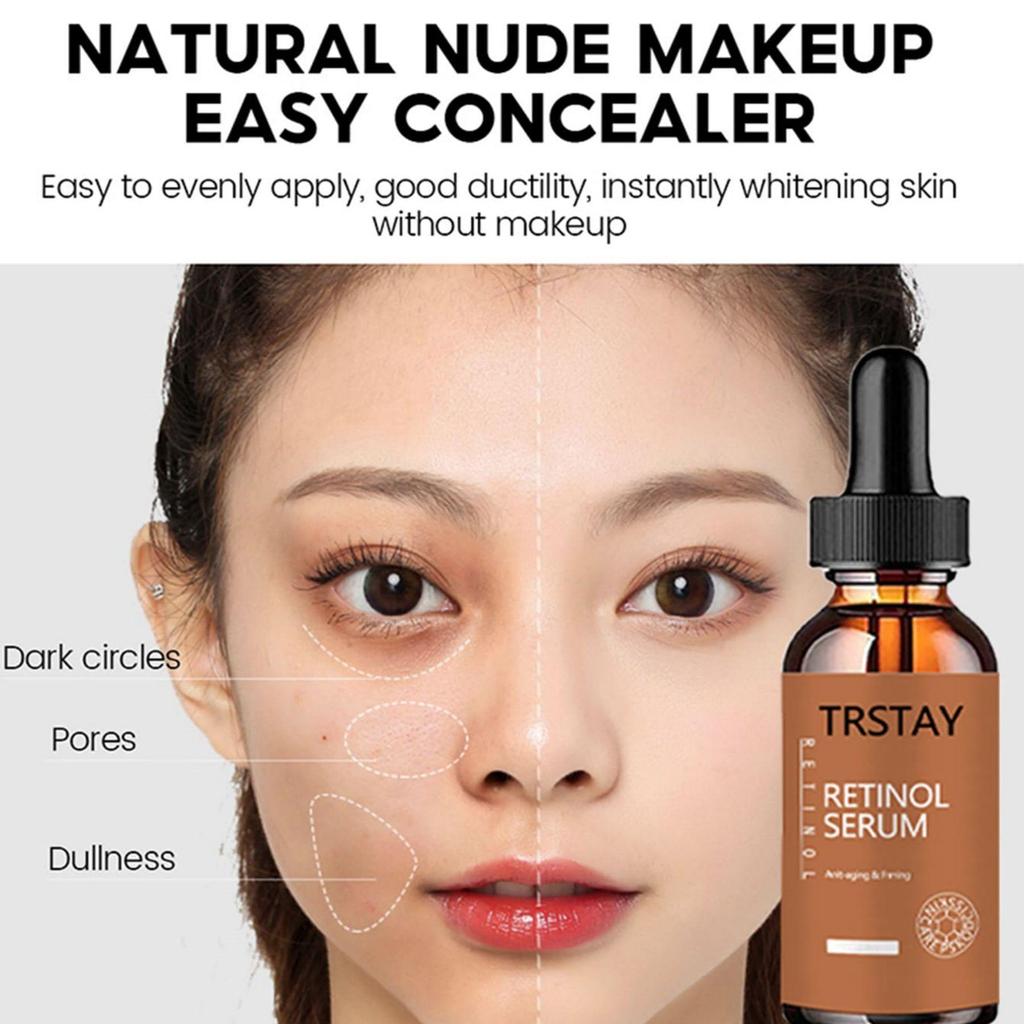 5ML/15ML/30ML/50ML/TRSTAY Effective Whitening Freckle Cream Remove Dark Spot Face Cream Removal  Melasma Lighten Brighten Smooth Skin Care