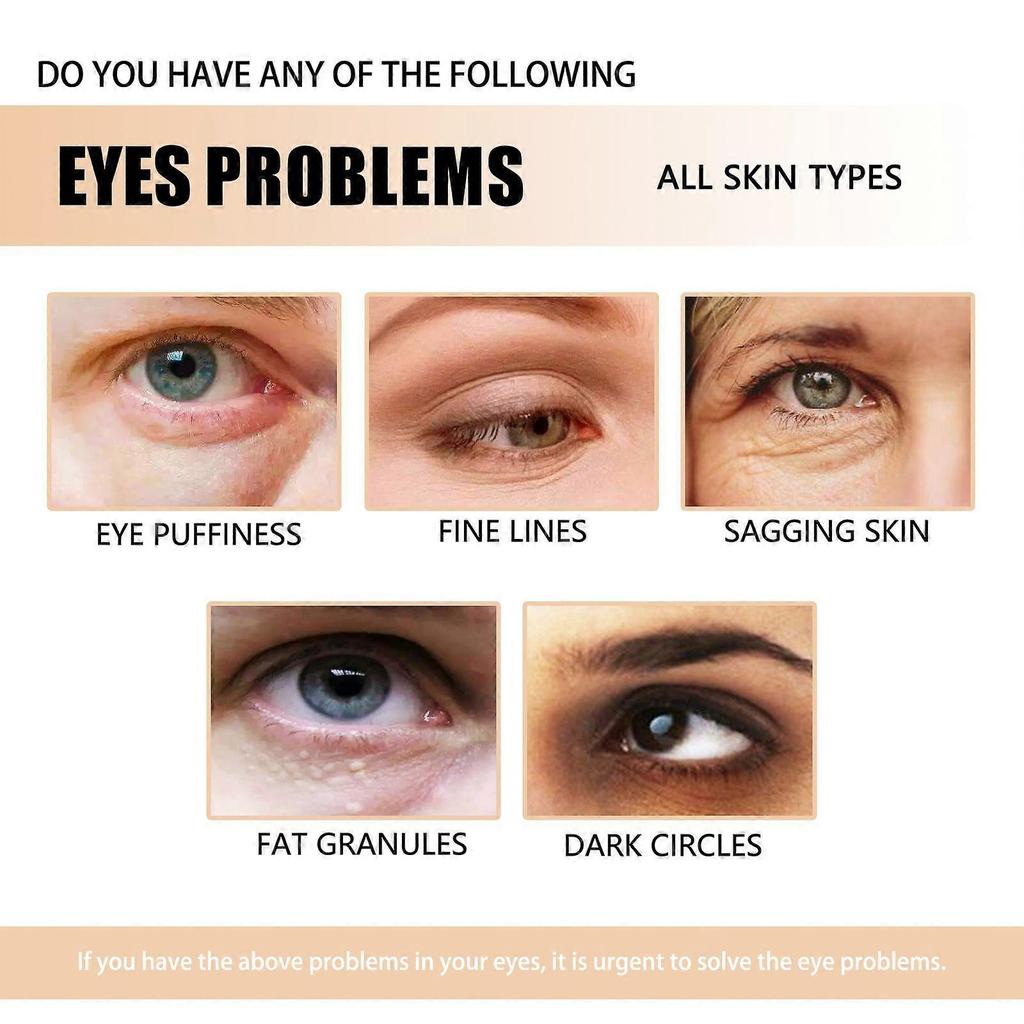 Jaysuing Eye Cream - Reduces Fine Lines And Dark Circles, Moisturizes Skin, Eye Care Tightening Cream