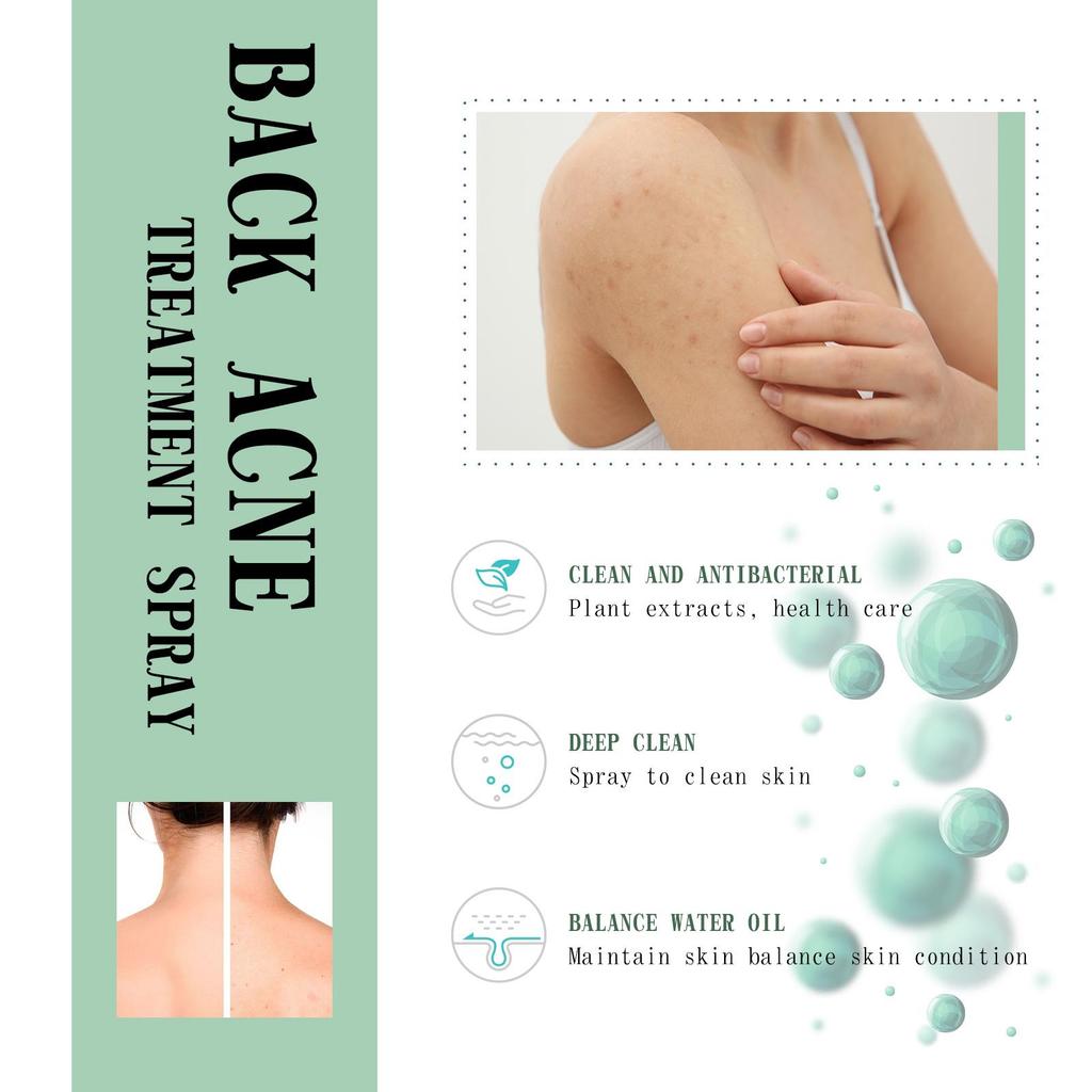 Jaysuing Back Acne Spray 120ml reduces blackheads and pimples, smooths skin, soothes back skin, gently moisturizes and cleanses.
