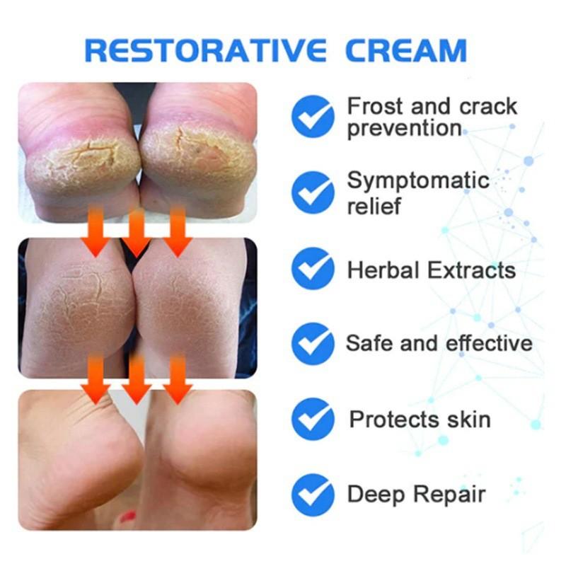 Ximonth Heel Repair Cream For Cracked Dry Skin Nourishing Moisturizing Foot Care 40g