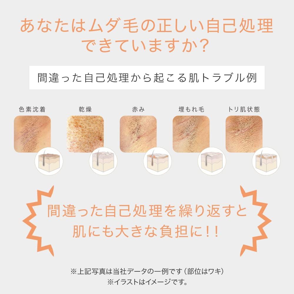 TBC Hikari Beauty 4 PRO Hair Removal Device with Cooling Home Light Hair Light Beauty Unwanted Hair Unwanted Hair Bikini Esthetic TBC Function, Use,