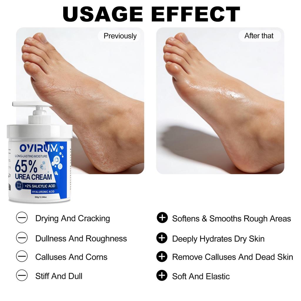 65% Urea Cream For Very Dry Heel And Hand, With Vitamin E, Hyaluronic Acid, Intensively Moisturizes & Nourishes Skin, Restores And Repair-350G