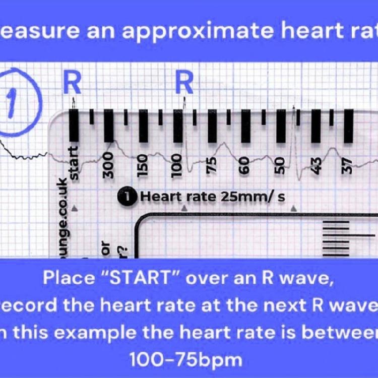 Electrocardiogram Assessment Tool 7 Step Ruler Card For Hospitals Clinics Healthcare Professional And Medicals Students