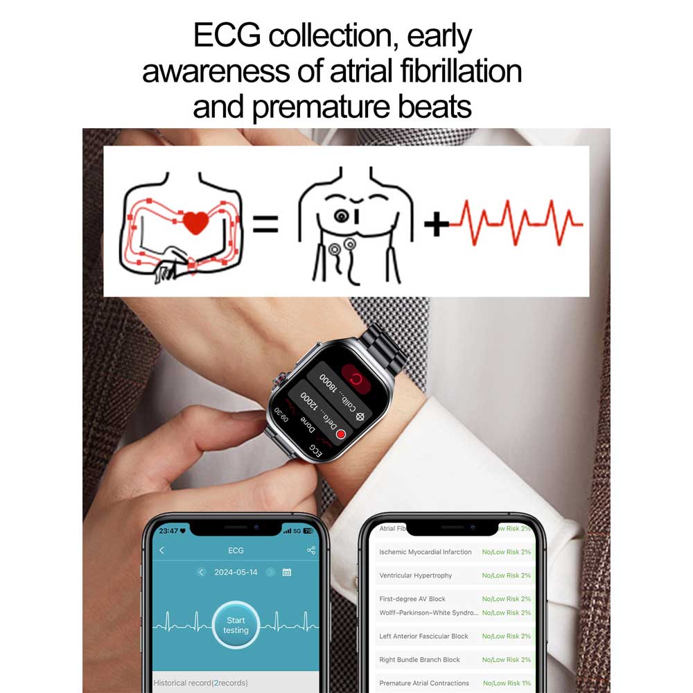 Micro-physical Examination AMOLED Smart Watch Men ECG Blood Compositoin Health Monitoring Bluetooth Call Women Sports Smartwatch