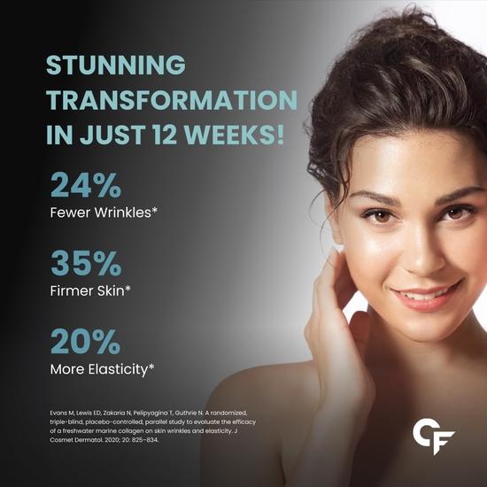 Carbamide Forte Marine Collagen Supplements for Skin & Hair | Marine Collagen Powder for Women & Men | Marine Collagen Supplements for Skin- 200g