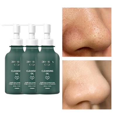 Puntos negros, sebo, marcas de poros, exfoliación, aceite limpiador centella cica, 3 piezas, 200ml