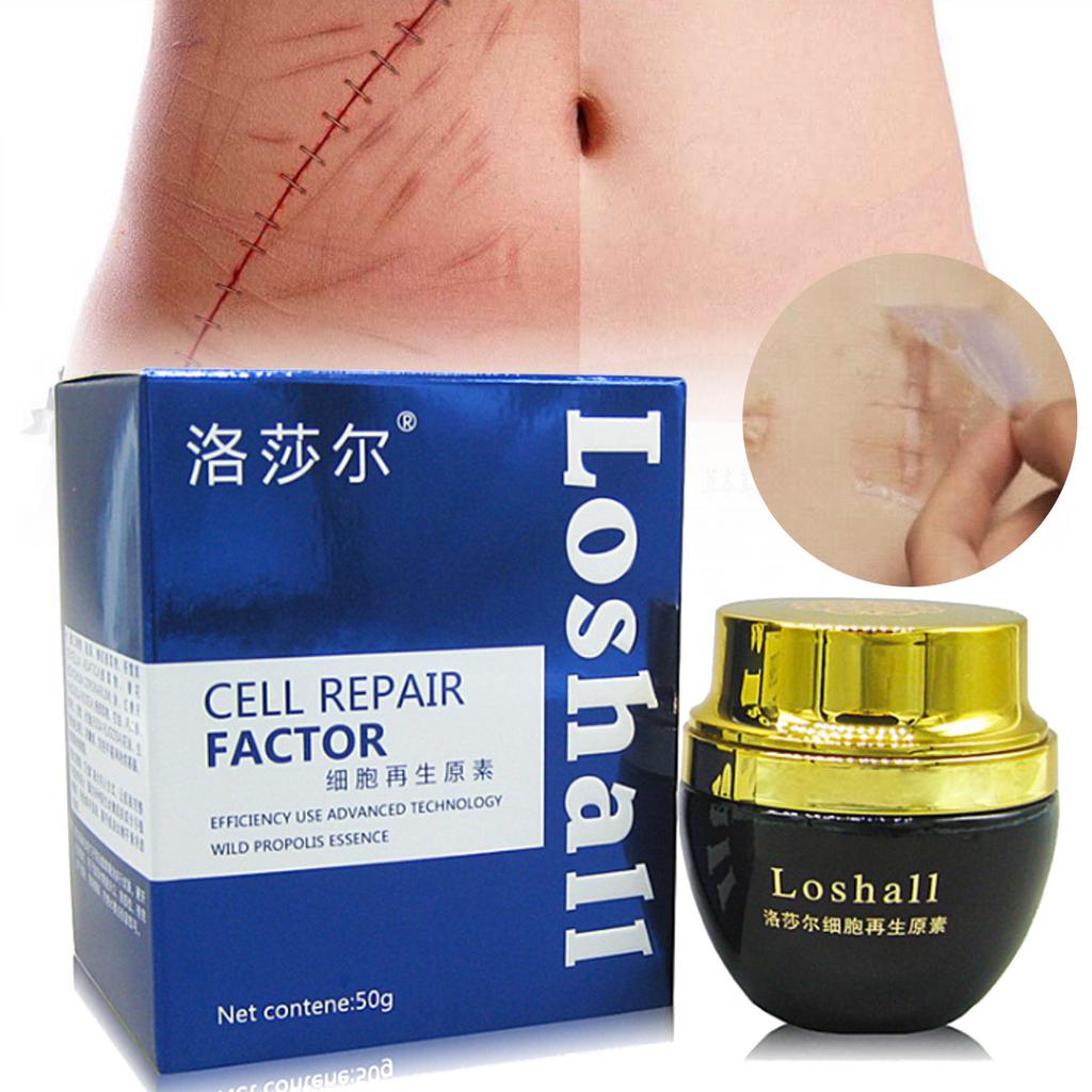 skin peeling cream for acne scars