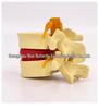 Genuine Lumbar Spine Protrusion & Vertebra Pathology Model