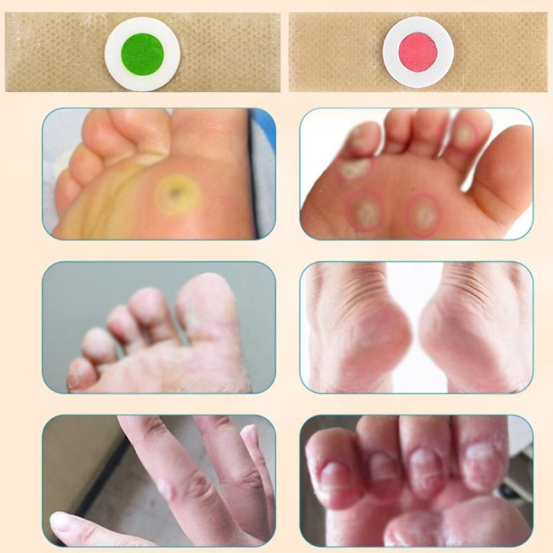 6/12/18/24/30/36 ks Náplast na odstranění kuřích ok a mozolů Clavus Náplast Podložky na kuří oka Náplasti Doplňky k obuvi Produkty pro péči o nohy