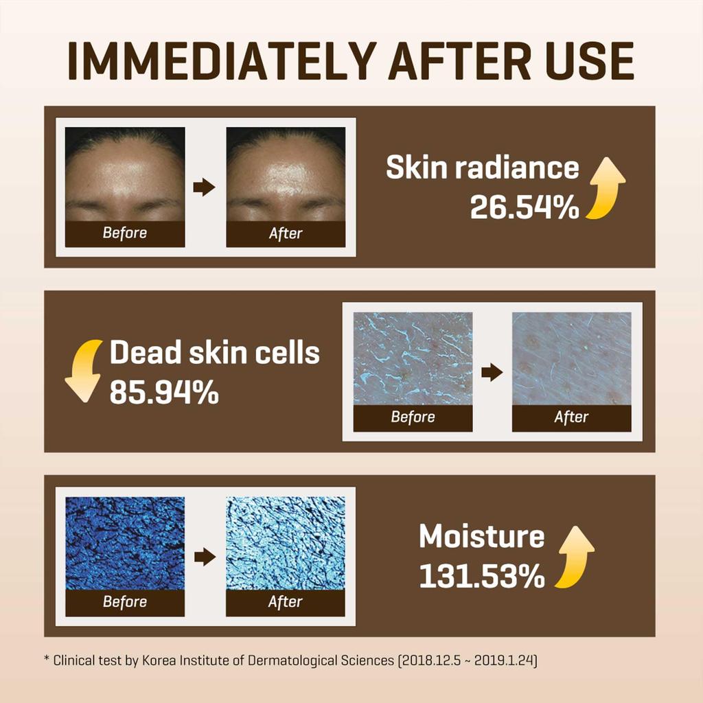 SOME BY MI Galactomyces Pure Vitamin C Glow Toner 200ml GALACTOMYCES PURE VITAMIN C GLOW TONER 200ml Dullness care Vitamin C Niacinamide Firmness care