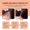 Raw Batana Oil for Hair Growth - 100% Pure, Organic Batana Oil for Thick and Strong, Prevent Loss for Men Women, 120ML Batana Oil for Repairs & Streng