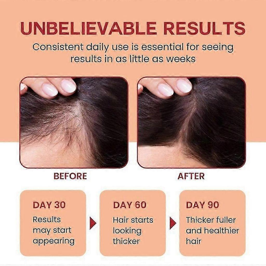 Raw Batana Oil for Hair Growth - 100% Pure, Organic Batana Oil for Thick and Strong, Prevent Loss for Men Women, 120ML Batana Oil for Repairs & Streng