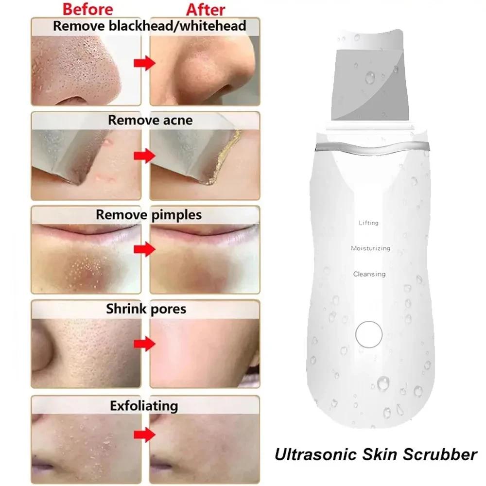 Ultrasonic Skin Scrubber Peeling Blackhead Remover Deep Face Cleaning Acne Pore Cleaner Facial Shovel Cleanser EMS Microcurrent
