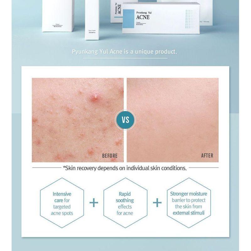 Pyunkang Yul Acne Dressing Mask Pack