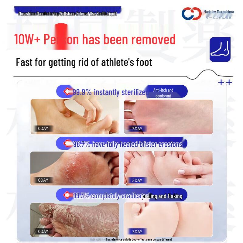 Wolf Poison Athlete's Foot Care Spray