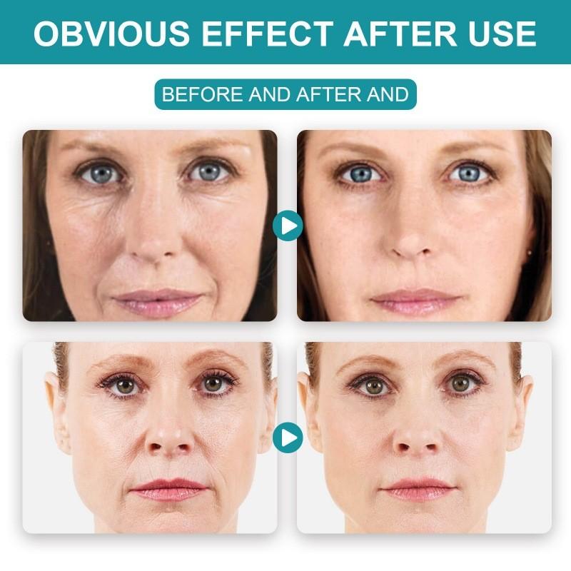 Wiyun Retinol Moisturizing Cream For Hydration Firming And Brightening Skin With 30g Size