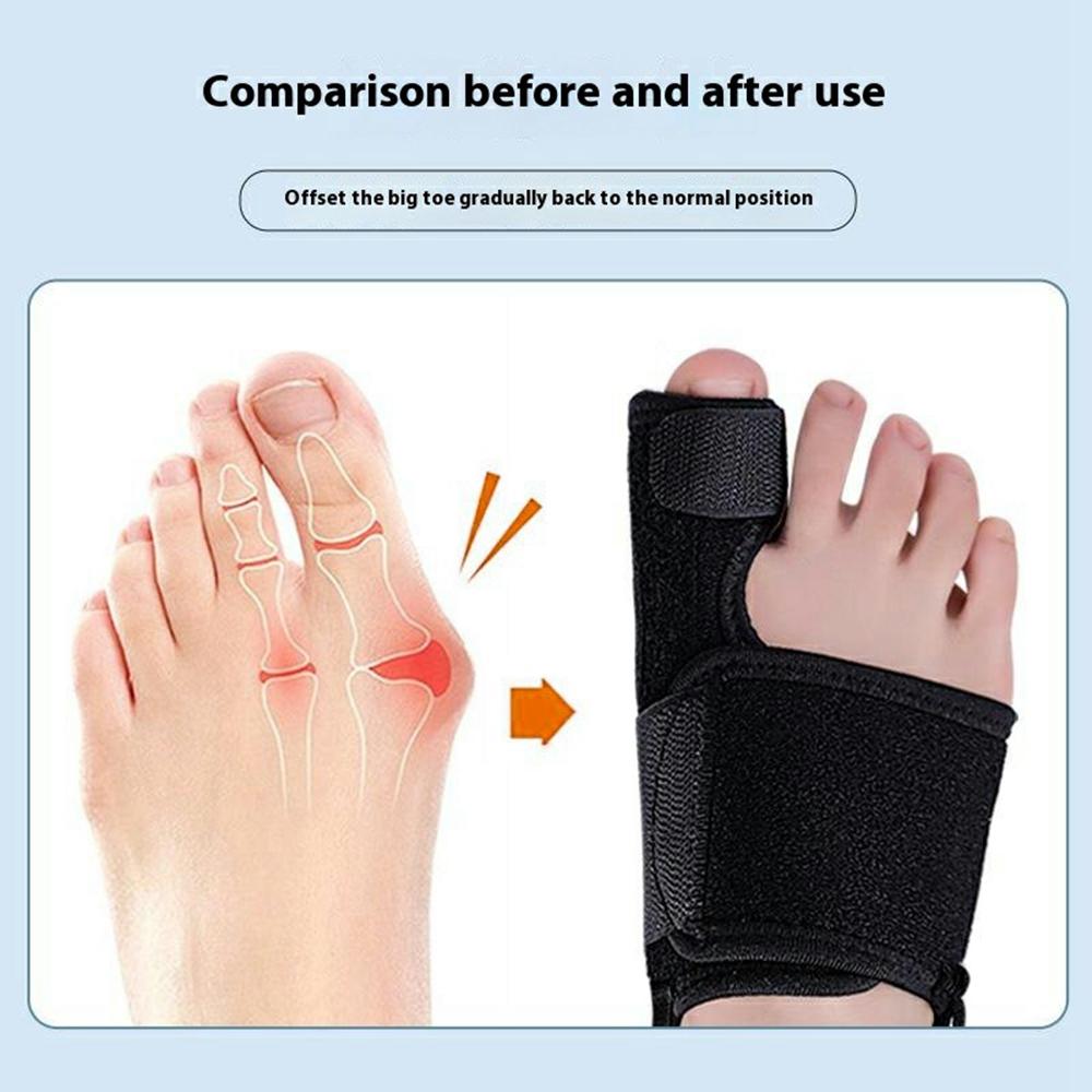 003 Bunion Corrector Adjustable Toe Separator Orthotics Feet Bone Thumb Adjuster Foot Care Tool Gift