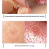 Elizavecca - Witch Piggy Hell Pore Blemish Spot Patch